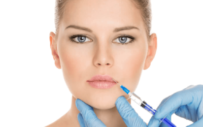 Preenchimento facial (ácido hialurônico) – Como ficar bonita