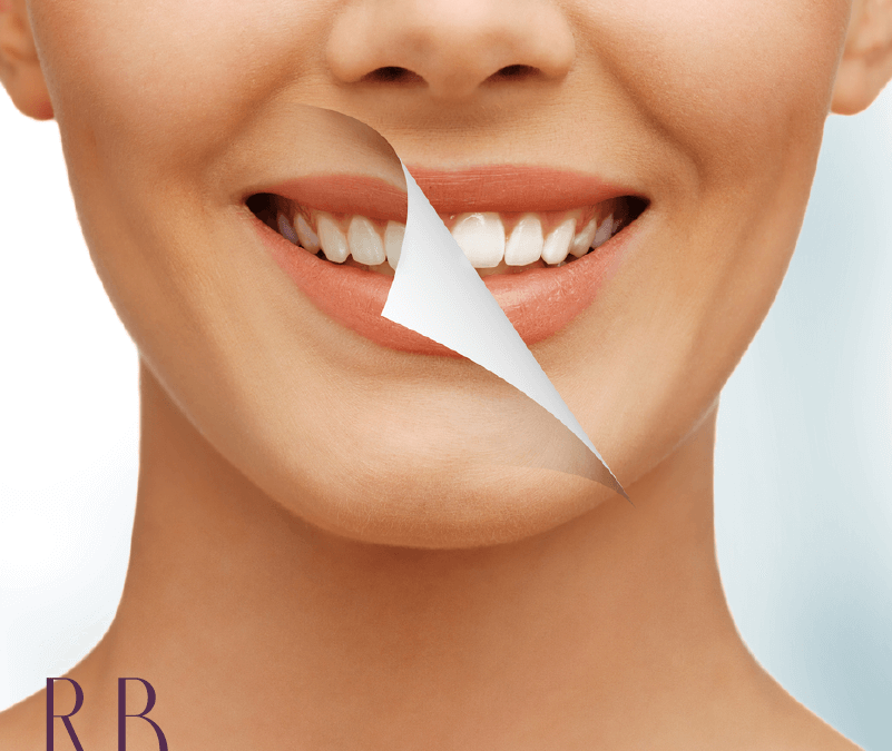 Reabilitação oral: um tópico importante sobre saúde bucal
