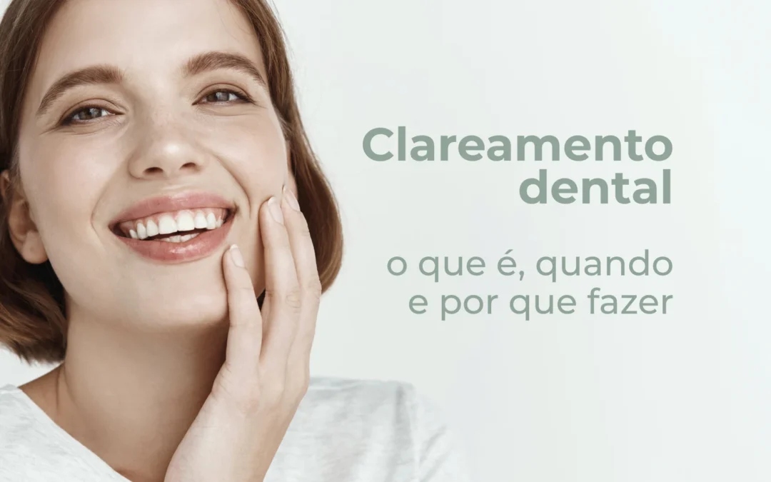 Clareamento dental: o que é, quando e por que fazer