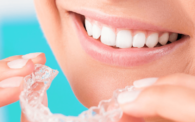 Tratamento Invisalign em BH – o aparelho transparente