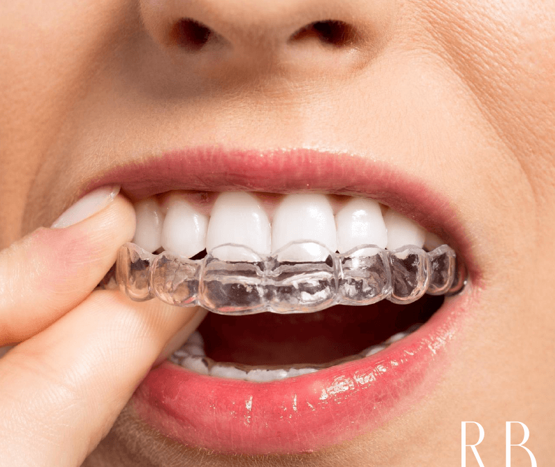 Transforme o seu sorriso! – Sobre ortodontia e o poder do sorriso