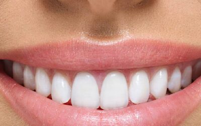 Ortodontia e reabilitação oral – implante dentário