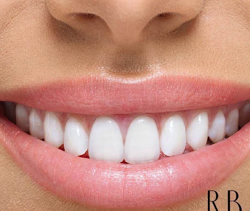 Ortodontia e reabilitação oral – implante dentário