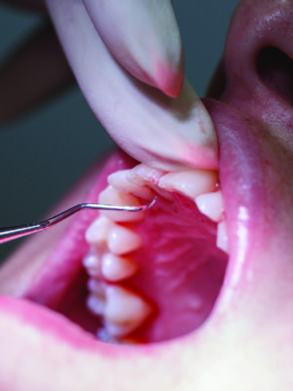 Periodontia - gengivas e saúde bucal Periodontia - gengivas e saúde bucal