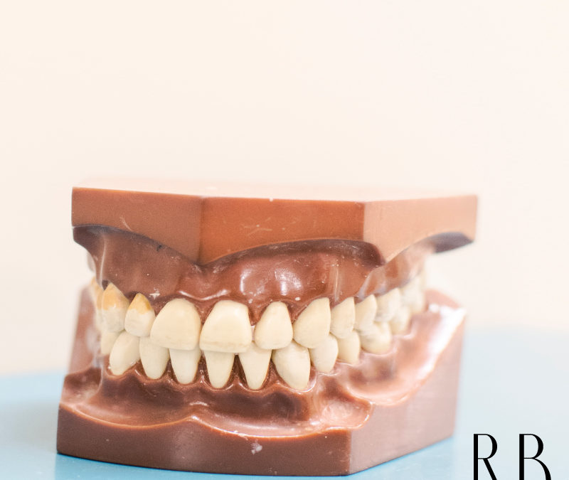 Clínica de implantes dentários em Belo Horizonte