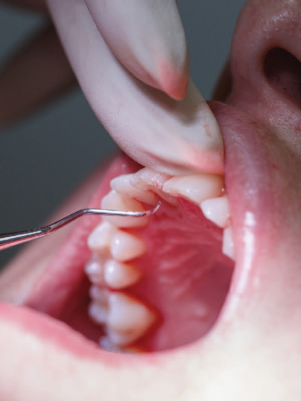 Periodontia - gengivas e saúde bucal Periodontia - gengivas e saúde bucal