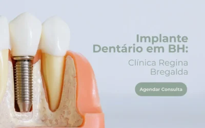 Implante dentário em BH: cuidados e indicações