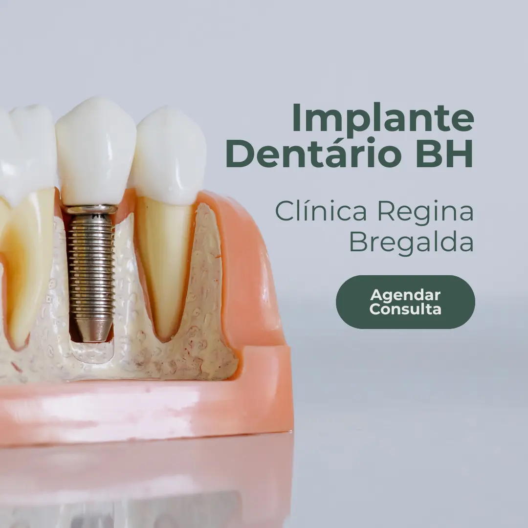 Entre em contato com a Clínica Regina Bregalda para realizar o seu implante dentário em Belo Horizonte