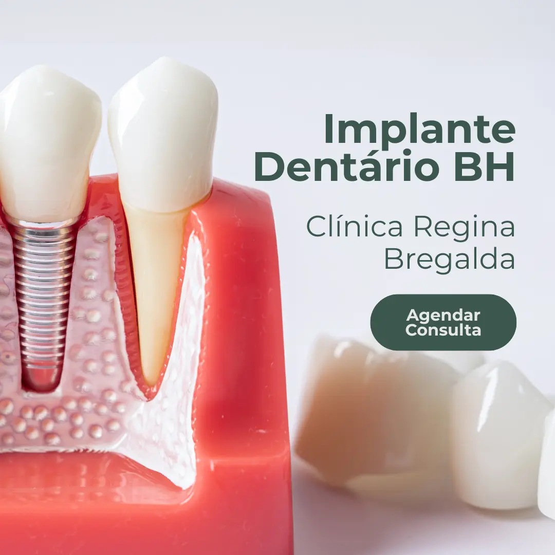 Entre em contato com a Clínica Regina Bregalda para saber o valor do implante dentário em Belo Horizonte