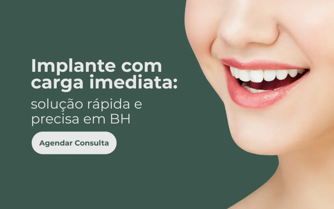 Implante com carga imediata: solução rápida e precisa em BH