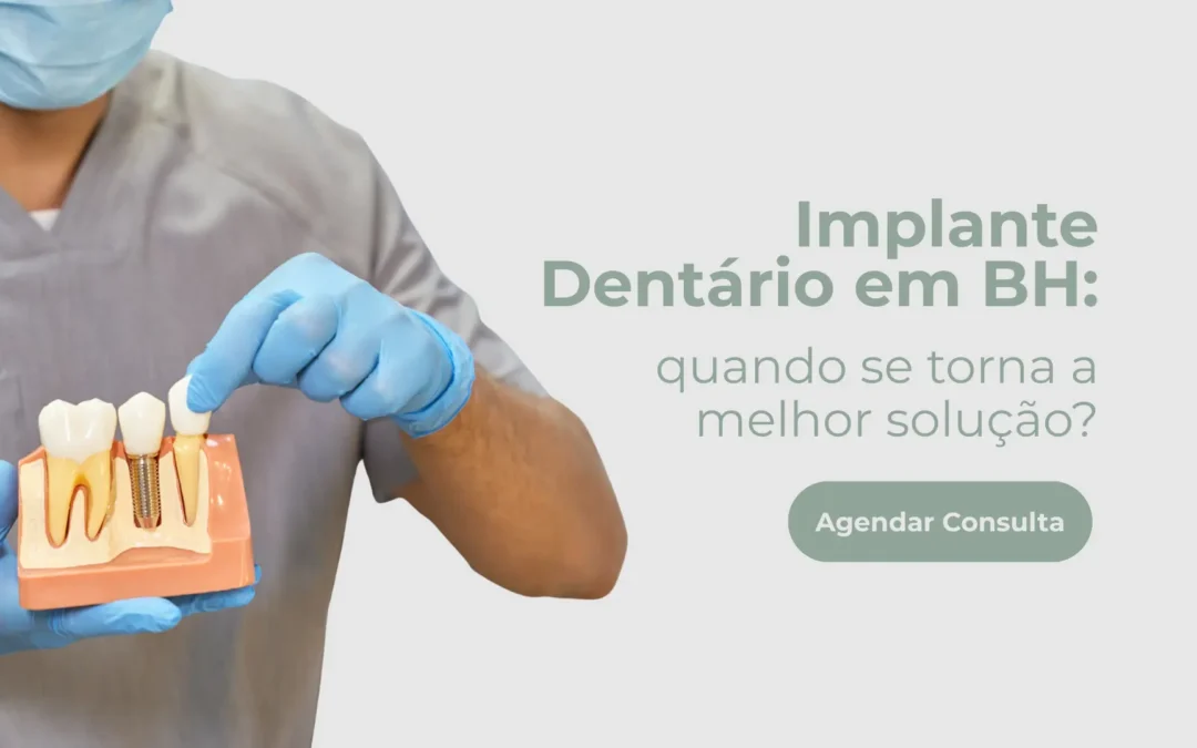Implante dentário: quando se torna a melhor solução?