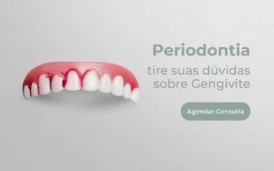 Periodontia: tire suas dúvidas sobre Gengivite