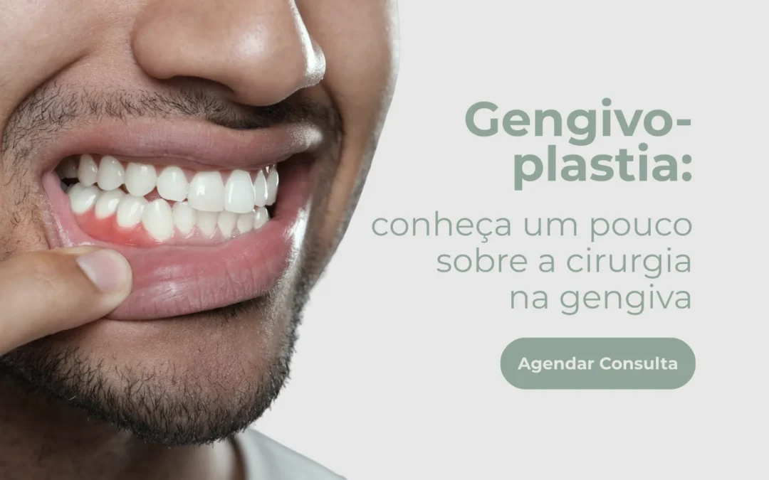 Gengivoplastia: conheça um pouco sobre a cirurgia na gengiva