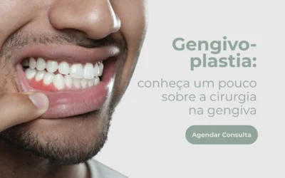 Gengivoplastia: conheça um pouco sobre a cirurgia na gengiva