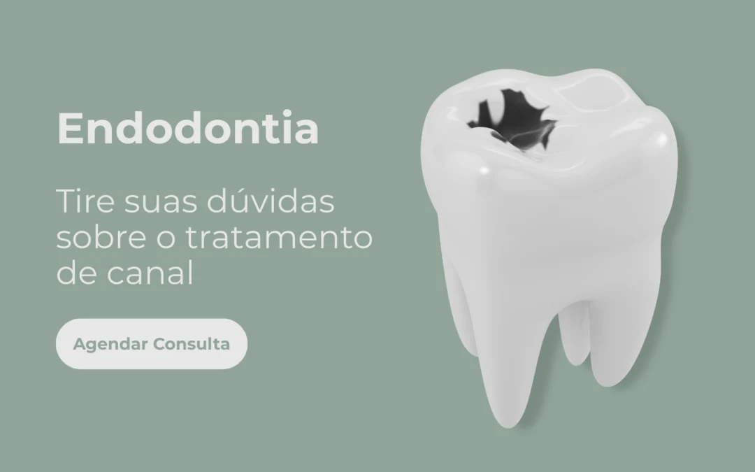 Endodontia – tira suas dúvidas sobre o tratamento de canal