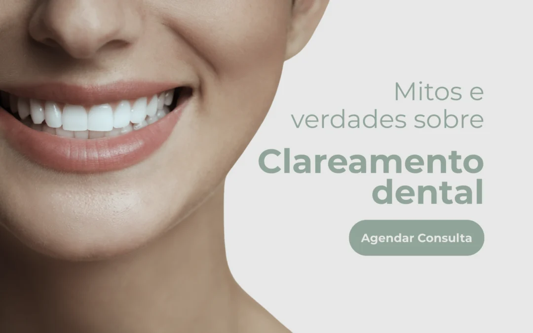 Mitos e verdades sobre o clareamento dental