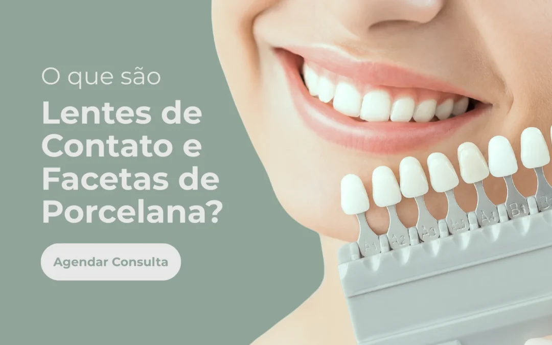 O que são lentes de contato dental e facetas de porcelana?