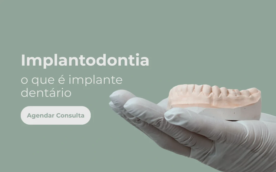 Implantodontia – o que é implante dentário?