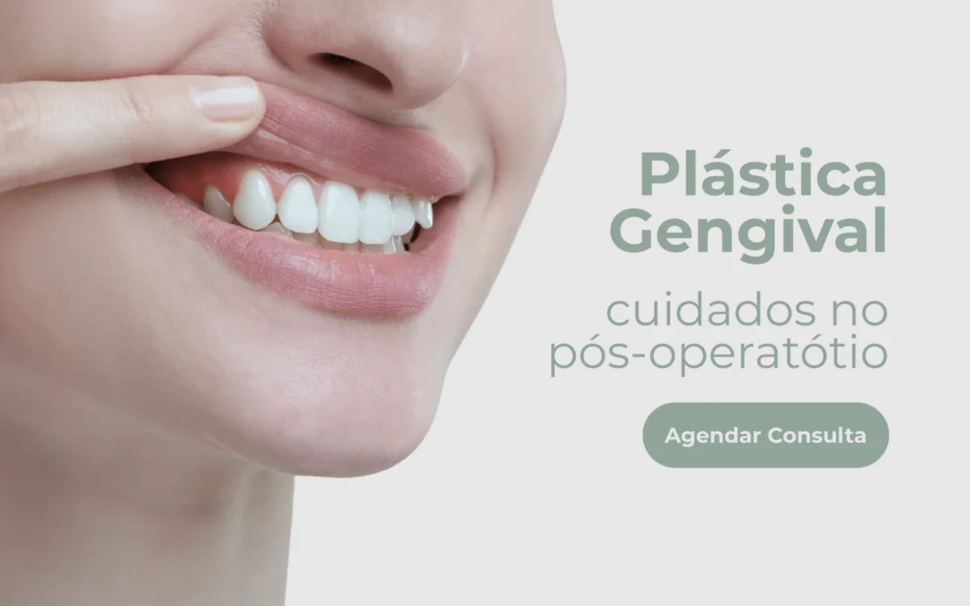 Plástica gengival – Cuidados no pós-operatório