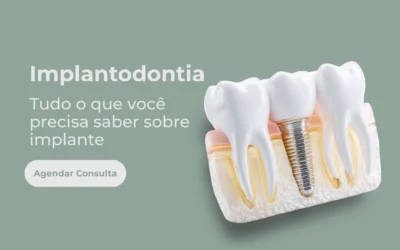 Implantodontia: tudo o que você precisa saber sobre implante