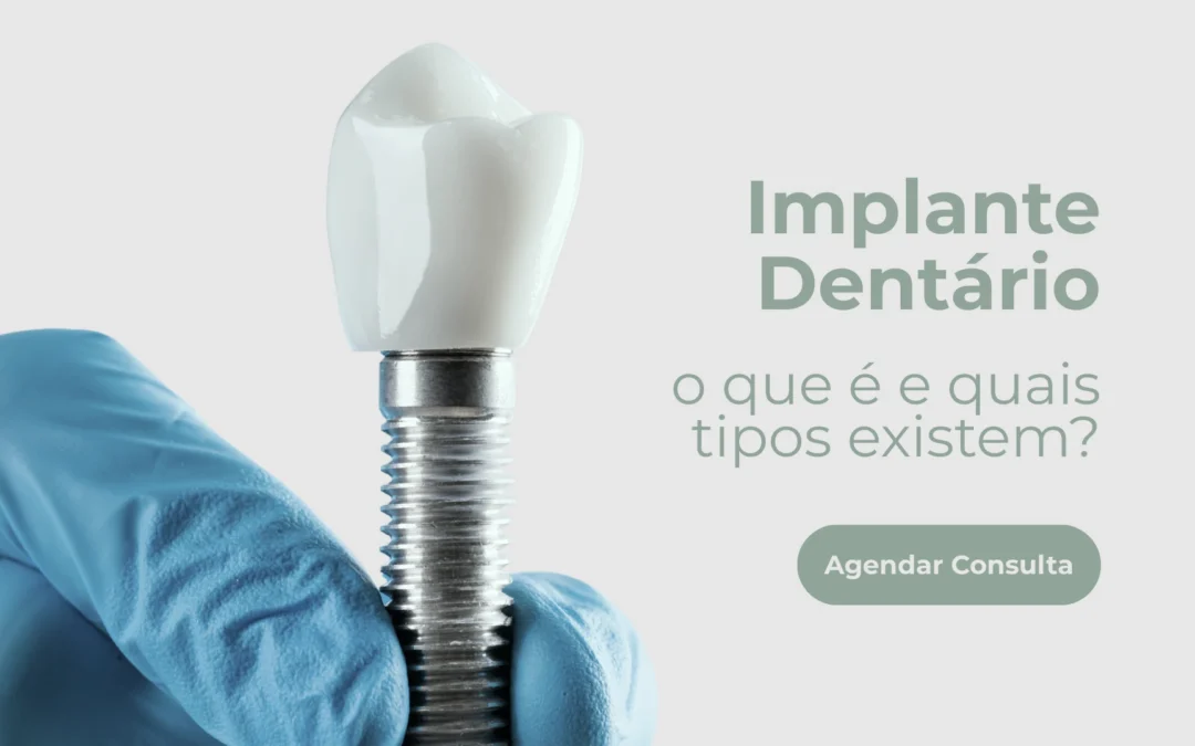 Implante dentário – o que é e quais tipos existem