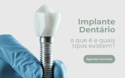 Implante dentário – o que é e quais tipos existem