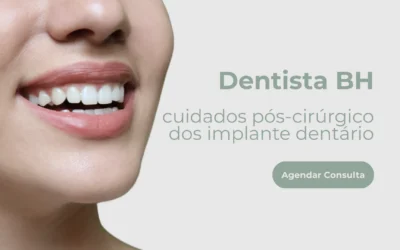 Dentista BH: cuidados pós-cirúrgico dos implante dentário