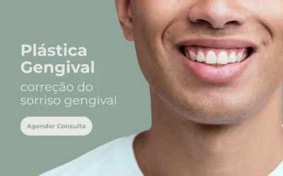 Plástica gengival – Correção do sorriso gengival