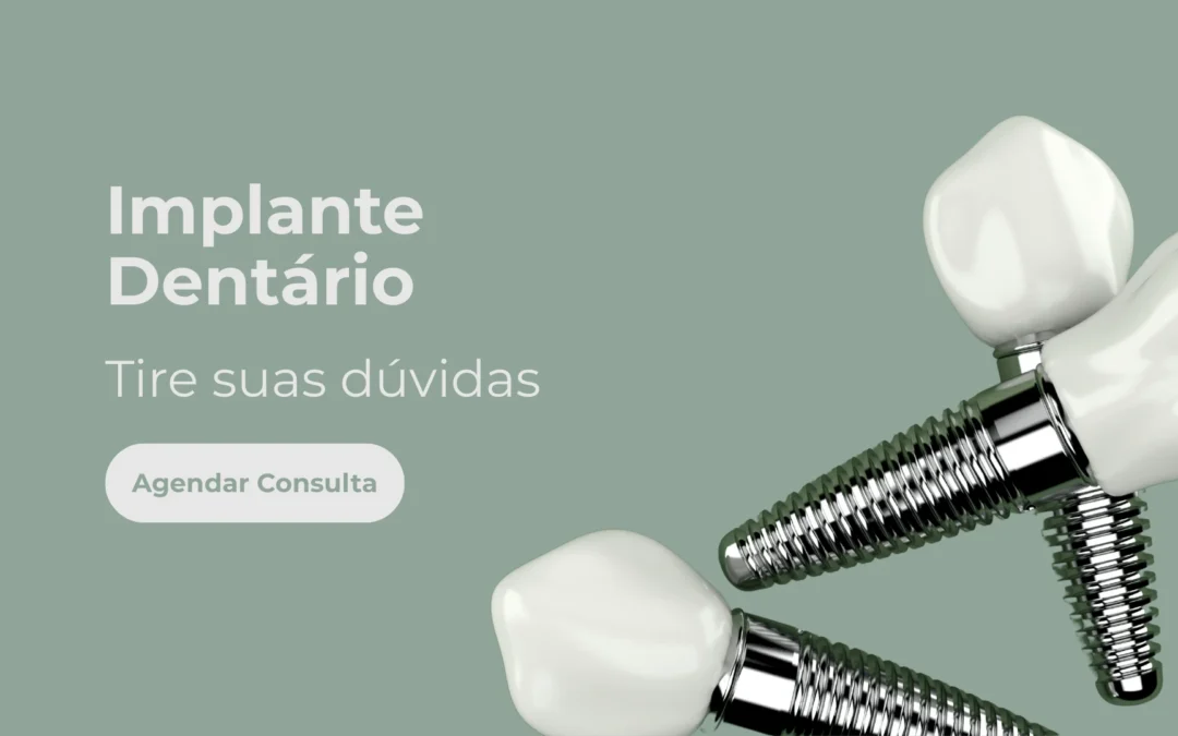 Implante dentário – Tire suas dúvidas