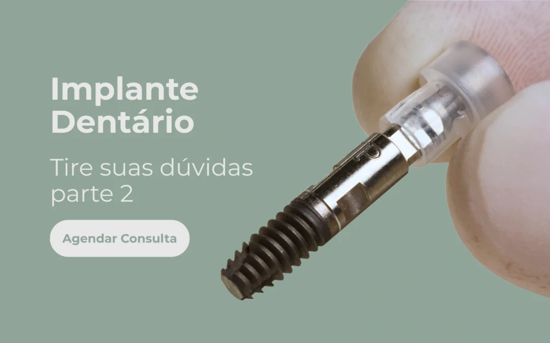 Implante dentário – Tire suas dúvidas – Parte 2