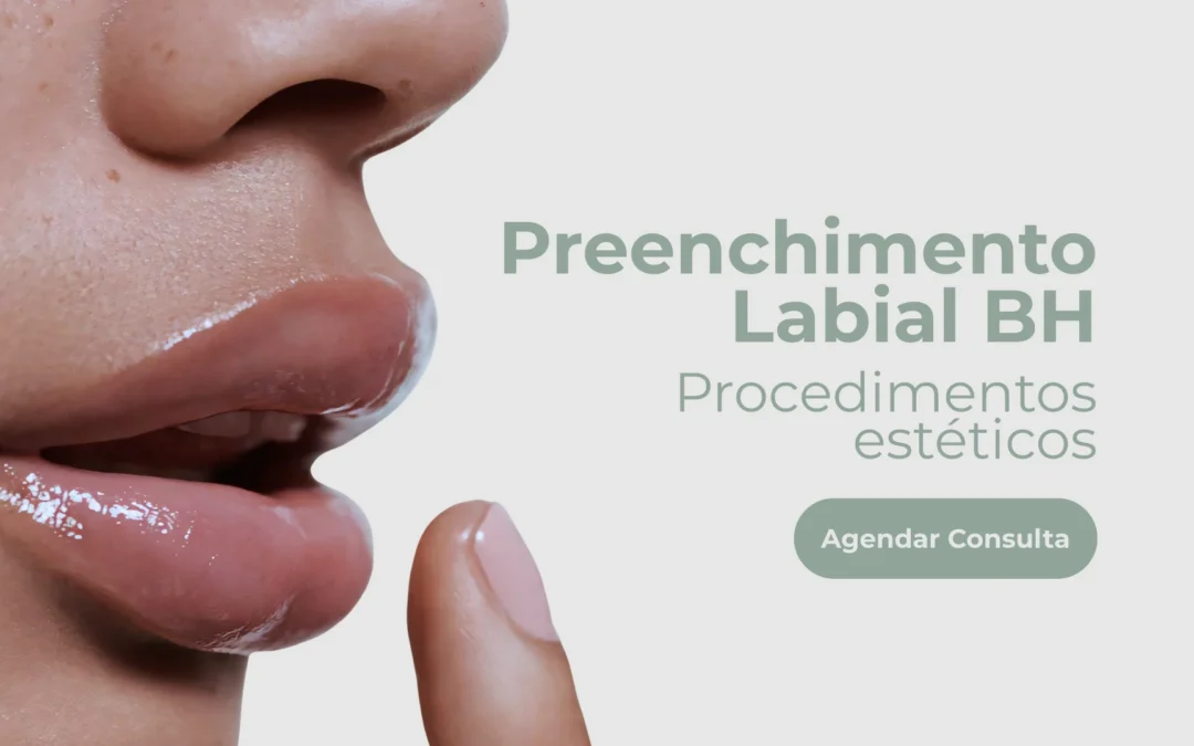 Preenchimento Labial BH – Procedimentos estéticos