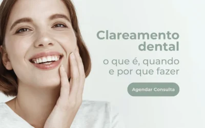 Clareamento dental: o que é, quando e por que fazer