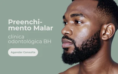 Preenchimento Malar – Clínica Odontológica BH