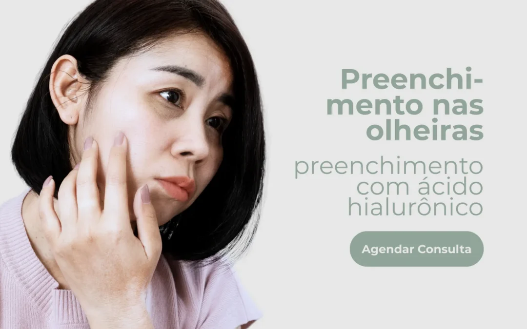 Preenchimento nas olheiras – Preenchimento com ácido hialurônico