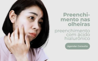 Preenchimento nas olheiras – Preenchimento com ácido hialurônico