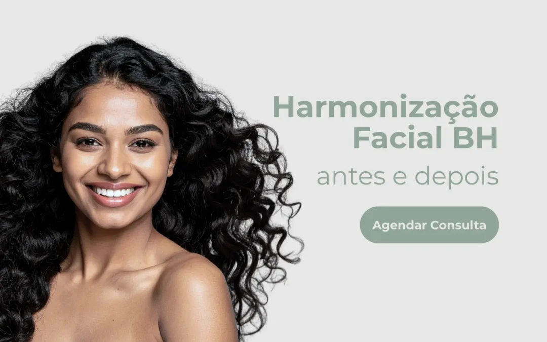 Harmonização Facial BH – Antes e Depois