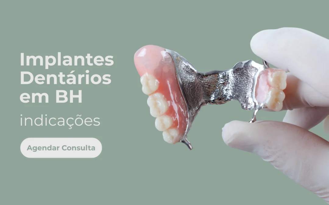Implantes Dentários em BH – Indicações