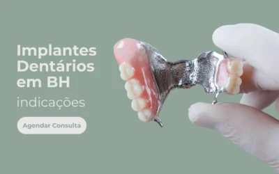 Implantes Dentários em BH – Indicações