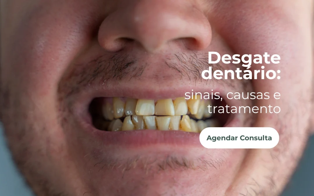 Desgaste dentário: causas, sinais e como tratar?
