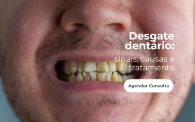 Desgaste dentário: causas, sinais e como tratar?