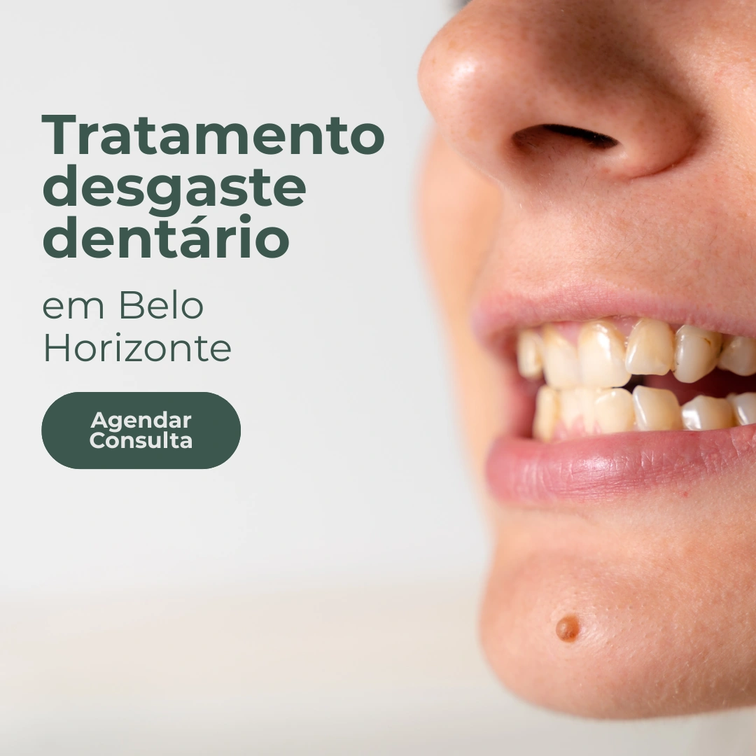 Entre em contato com a Clínica Regina Bregalda para realizar tratamento de desgaste dentário