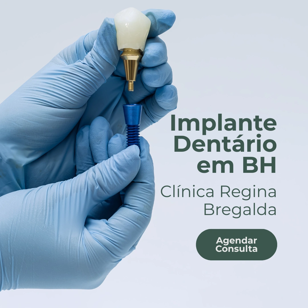 Entre em contato com a Clínica Regina Bregalda para saber sobre mitos e verdades sobre os implantes dentários em Belo Horizonte