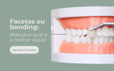 Facetas ou bonding: qual opção dura mais nos dentes?