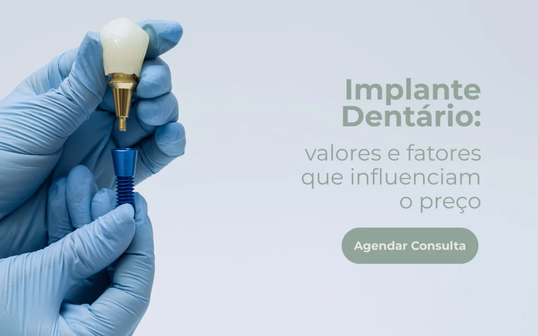 Implante dentário: valores e fatores que influenciam o preço