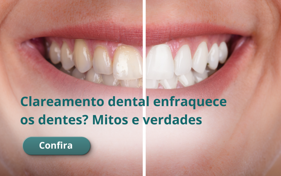 Clareamento dental enfraquece os dentes? Mitos e verdades