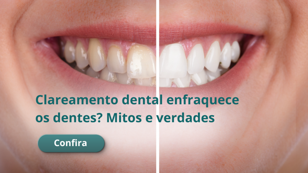 Clareamento dental enfraquece os dentes Mitos e verdades