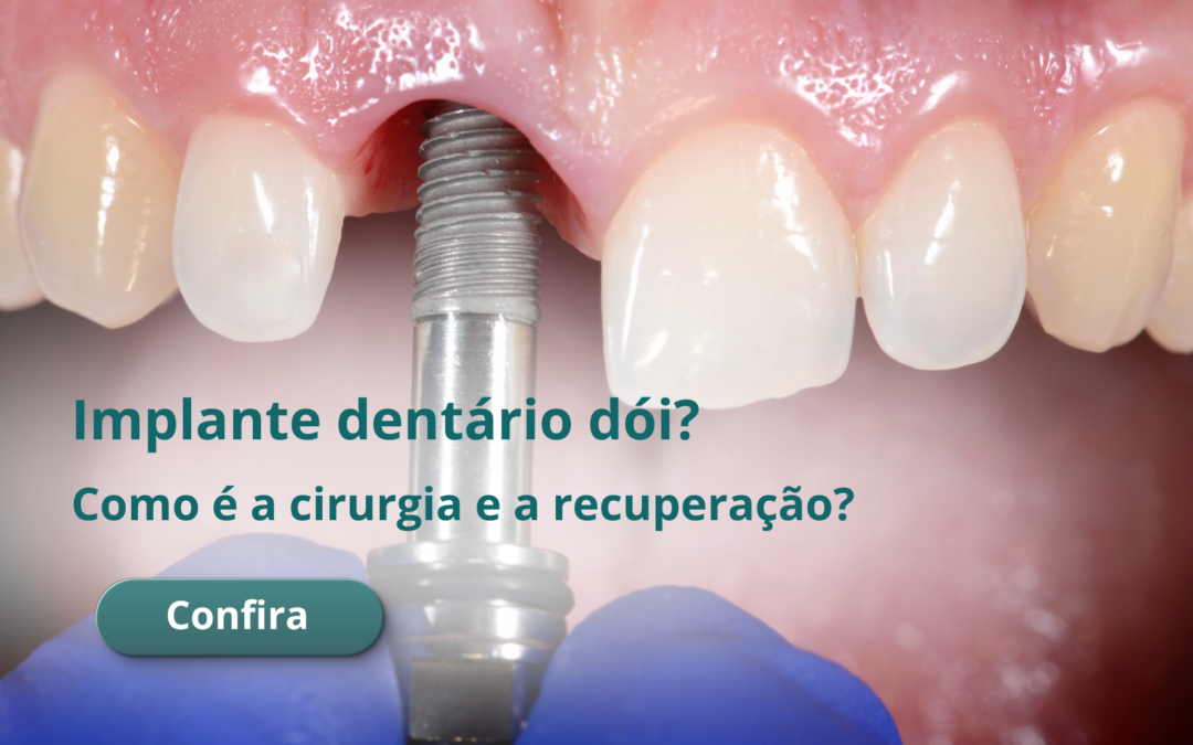 Implante dentário dói? Como é a cirurgia e a recuperação?