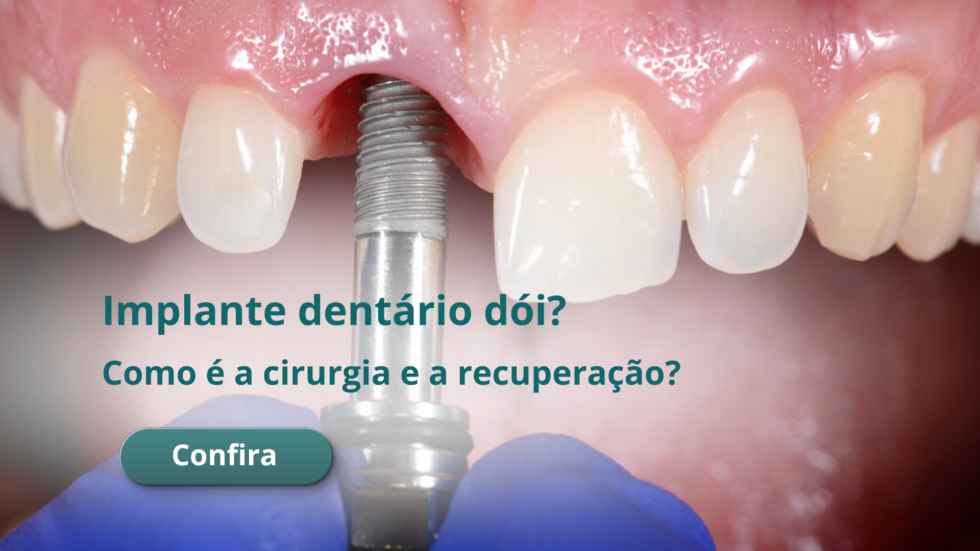 Quanto custa um implante dentário em BH em 2026