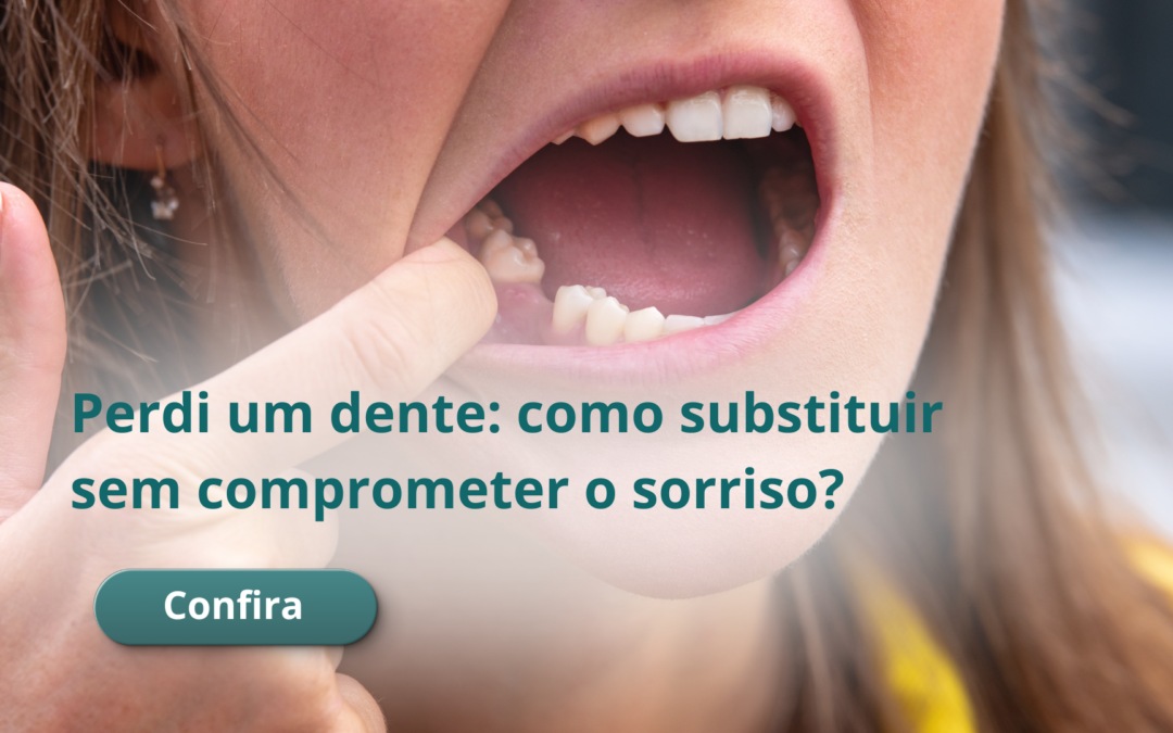 Perdi um dente: quais são as opções para substituir sem comprometer o sorriso?