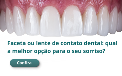 Faceta ou lente de contato dental: qual a melhor opção para o seu sorriso?